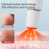 Electronic Mosquito Bite Pen: Chemical-free, natural heat anti-itch for adults, kids, camping, travel.